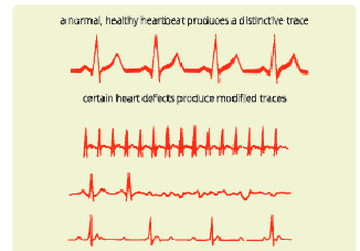 The-circulatory-system-Electrocardiogram-(ECG)