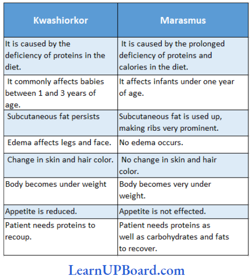 NEET Biology Digestion And Absorption Differences Between Kwashiorkor And Marasmus