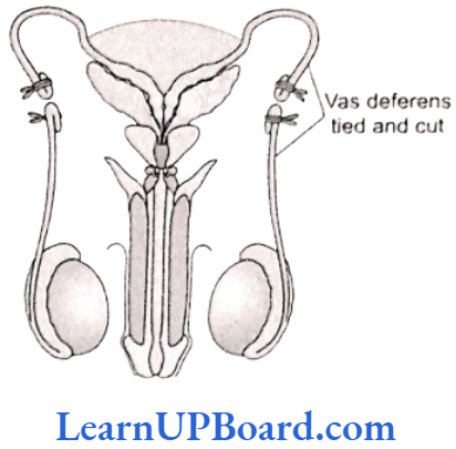 NEET Biology Reproductive Vasectomy