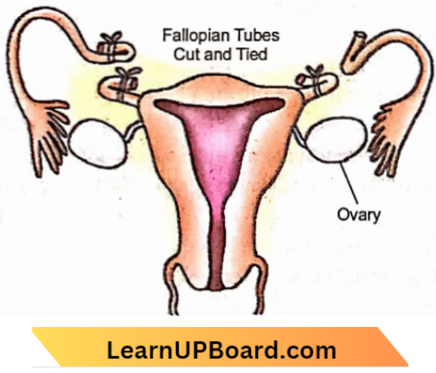 Sexual Reproduction Fallopian Tubes And Cervix And Uterus